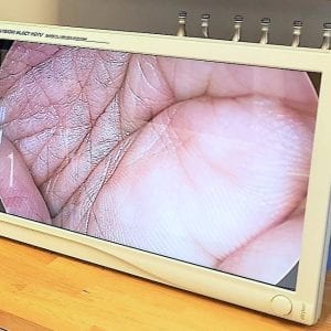 LOCAÇÃO Monitor Stryker HD 26 polegadas - SEMINOVO