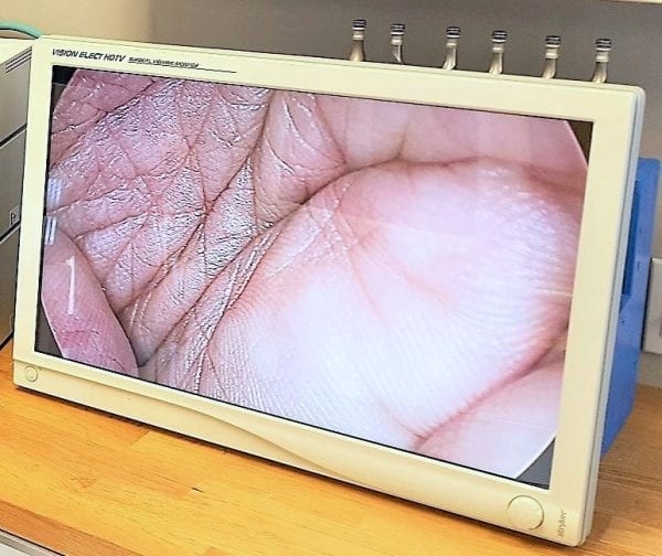 LOCAÇÃO Monitor Stryker HD 26 polegadas - SEMINOVO